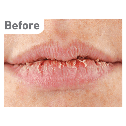 O'Keeffe's Lip Repair - GOLDFARMACI